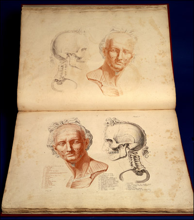 Left, a figure in the style of Greco-Roman portrait sculpture, showing  musculature of the face. Right, the skull of the same figure looks on. Jean-Galbert Salvage, Anatomie du gladiateur combattant, applicable aux beaux arts... (Paris, 1812). Two-layer copperplate engraving, color.  Two-page view.