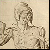 A dissected woman wears a peasant’s hat. Cropped, from Giulio Casserio, Tabulae Anatomicae (Venice, 1627). Copperplate engraving. Artist: Odoardo Fialetti. 