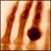 A blurry x-ray of four fingers, one of them with a large ring. Cropped, from The hand of Mrs. Wilhelm Roentgen: the first X-ray image, 1895. In Otto Glasser, Wilhelm Conrad Röntgen and the early history of the Roentgen rays (London, 1933). 