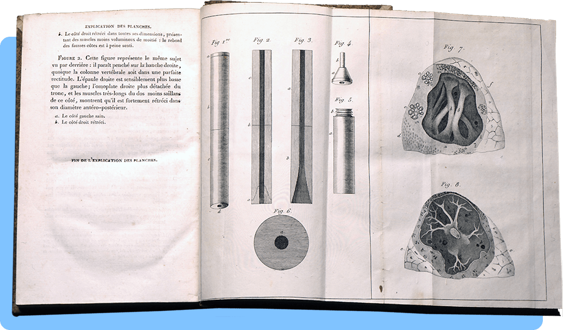 A book open to a page of French text on the left and fold-out plate on the right showing six diagrams of a stethoscope and two parts of the human lung