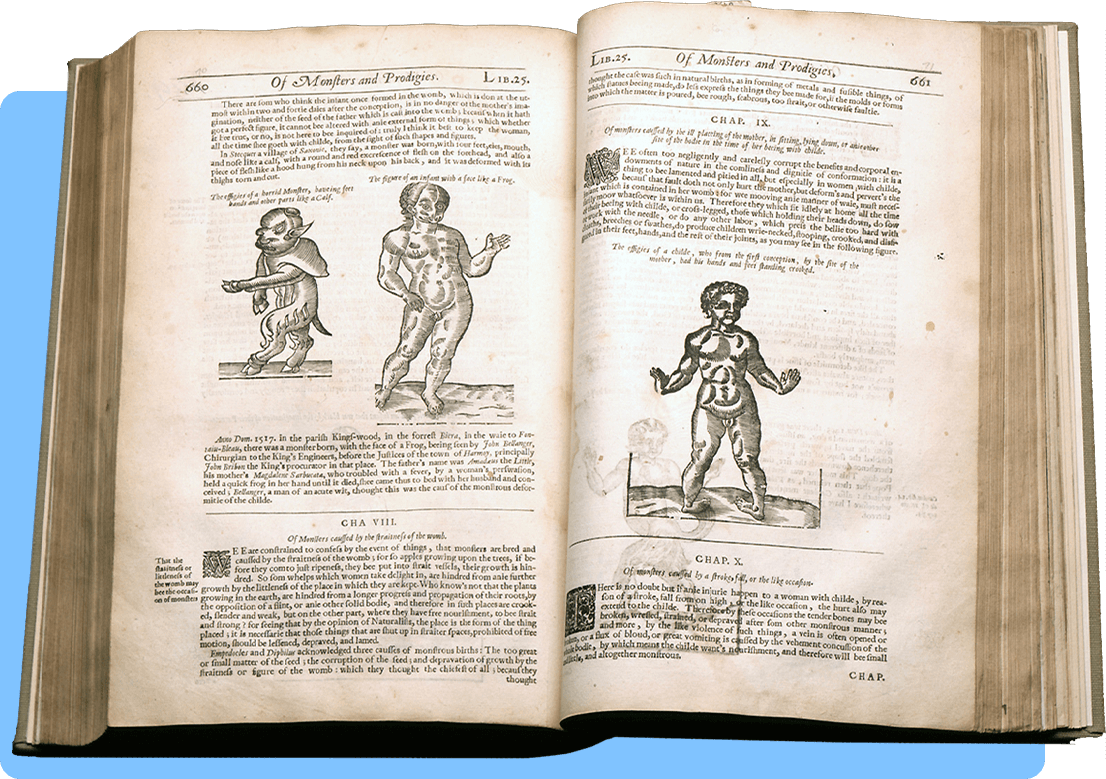 A book open to a two page spread with Latin text and three anatomical illustrations of two monsters and one standing infant 
