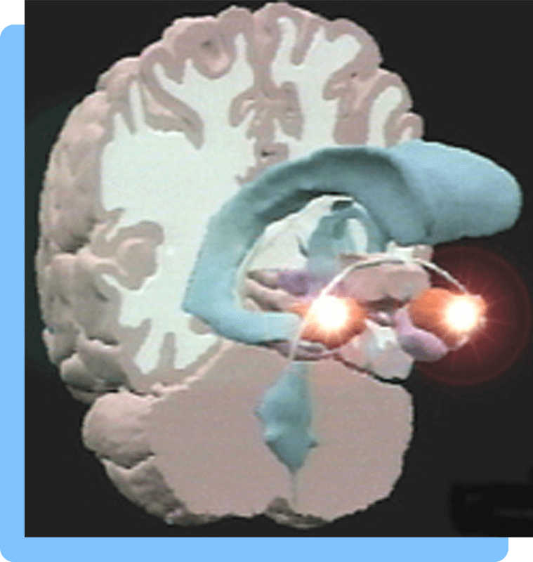 Digital image of a human brain that has been cut in half to show where the amygdala is located