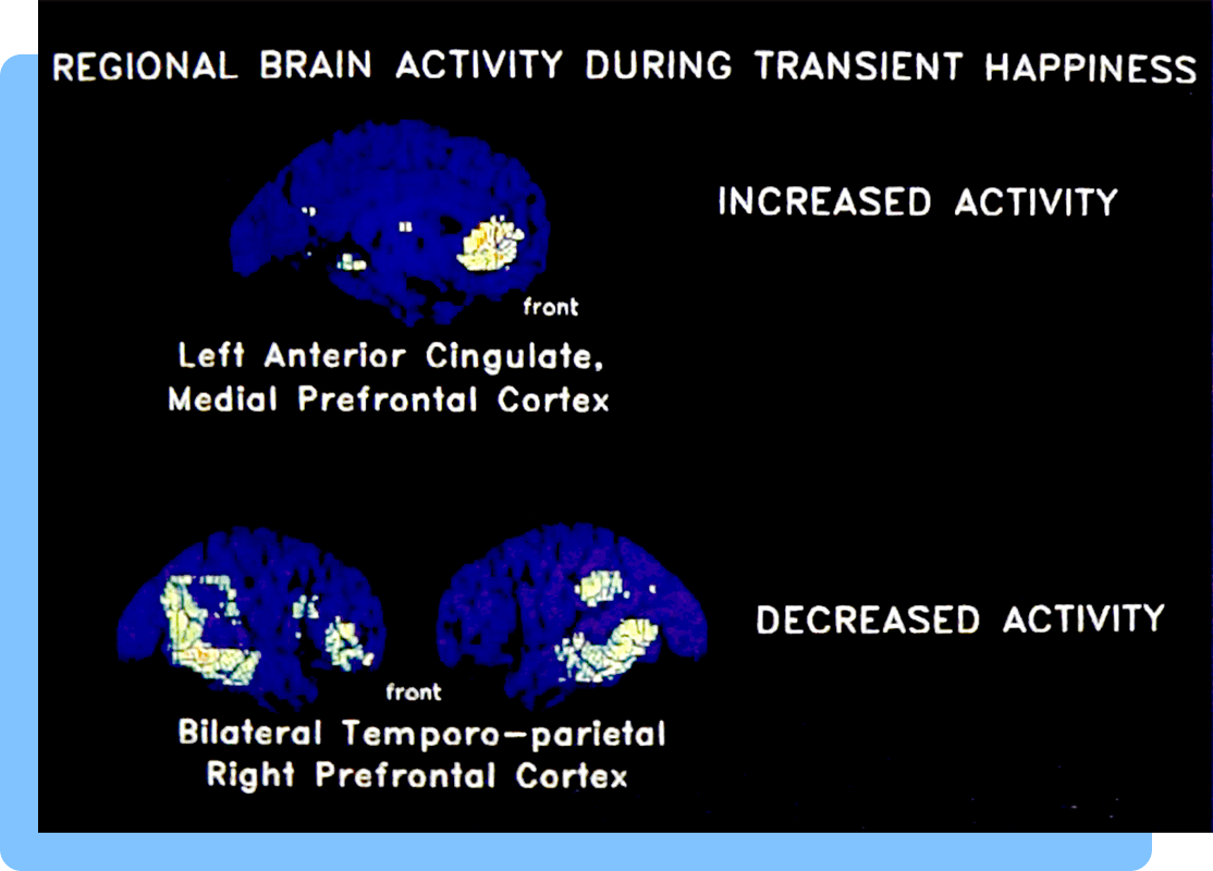 Digital scans of the brain in blue showing neural activity in white, surrounded by text and labels