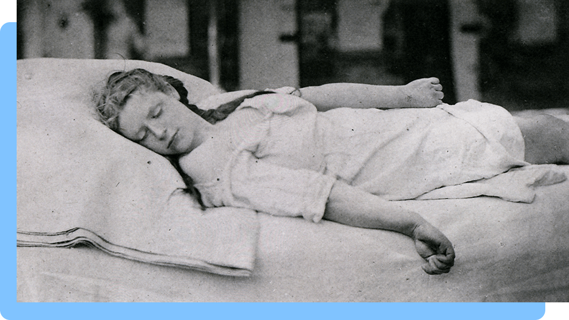 A White woman lying in a hospital bed with her eyes closed