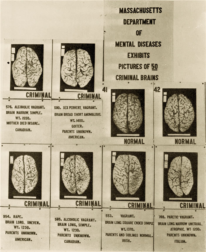 Eight human brains with their criminal offenses, family history, and ethnicities listed.
