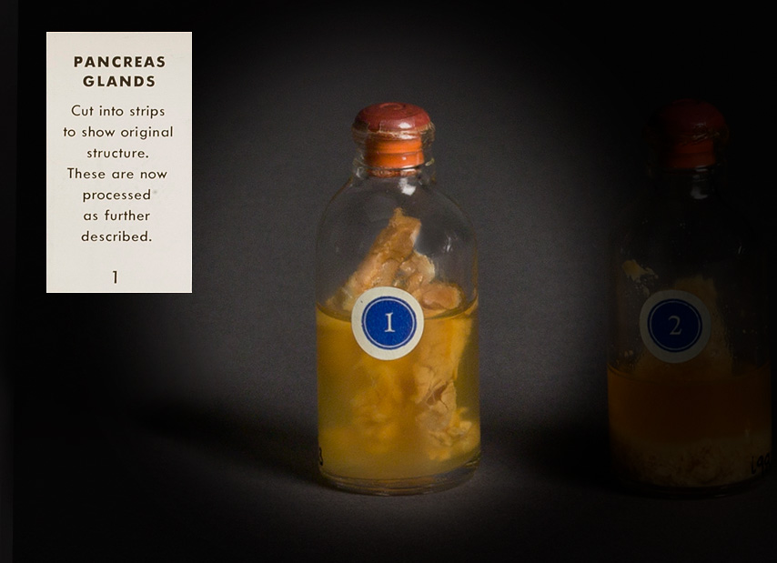 A clear glass bottle sealed and labeled &#8220;1,&#8221; contains sections of pancreas half immersed in yellow murky liquid.