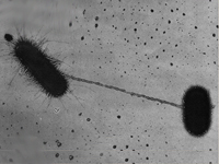 Microphotograph of two E. coli bacteria exchanging DNA through conjugation. Four views of E. coli bacteria by scanning electron microscope.
