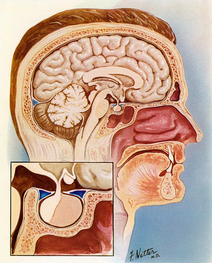 Нос и головной мозг. Гипофиз в турецком седле. Анатомия турецкого седла в головном мозге. Гипофиз бези. Гипоталамус турецкое седло.