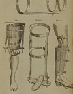 page 146 of A system of surgery