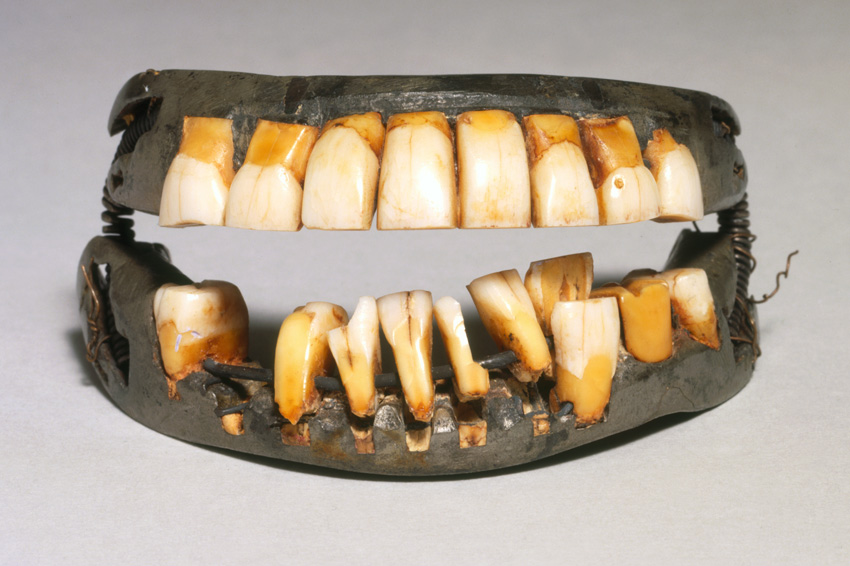 Yellowing-teeth dentures, some teeth missing, top and bottom piece held together by wire springs.