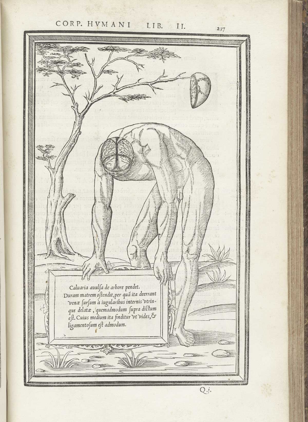 Woodcut of nude male figure in a pastoral setting standing and bowing forward facing downward and to the left, giving a view of the top of his head with the top of the skull removed to show the dura and arachnoid maters, while in the background to the right hangs the top of his skull from the branch of a naked tree; below him is a tablet naming the structures in Latin; from Charles Estienne’s De dissection partium corporis humani libri tres, NLM Call no.: WZ 240 E81dd 1545.