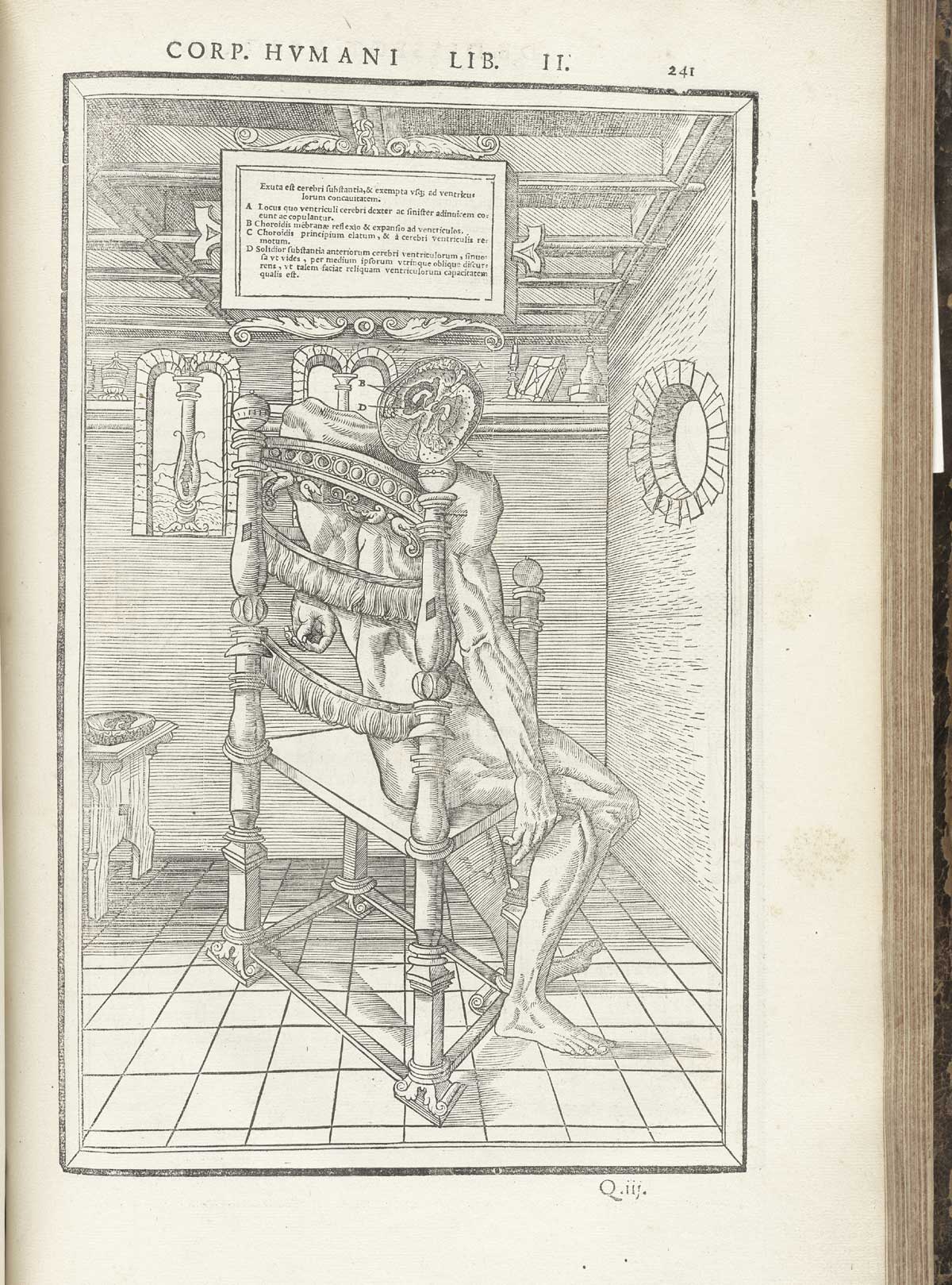 Woodcut of a nude male figure seated in a chair facing away from the viewer in a room with a round window to the right, a rectangular window to the left, and a small bookshelf above, with the cadaver giving a view of the top of his head with the top of the skull and half of the brain removed to show interior of the cerebral cortex, while above is a tablet naming the structures in Latin; from Charles Estienne’s De dissection partium corporis humani libri tres, NLM Call no.: WZ 240 E81dd 1545.