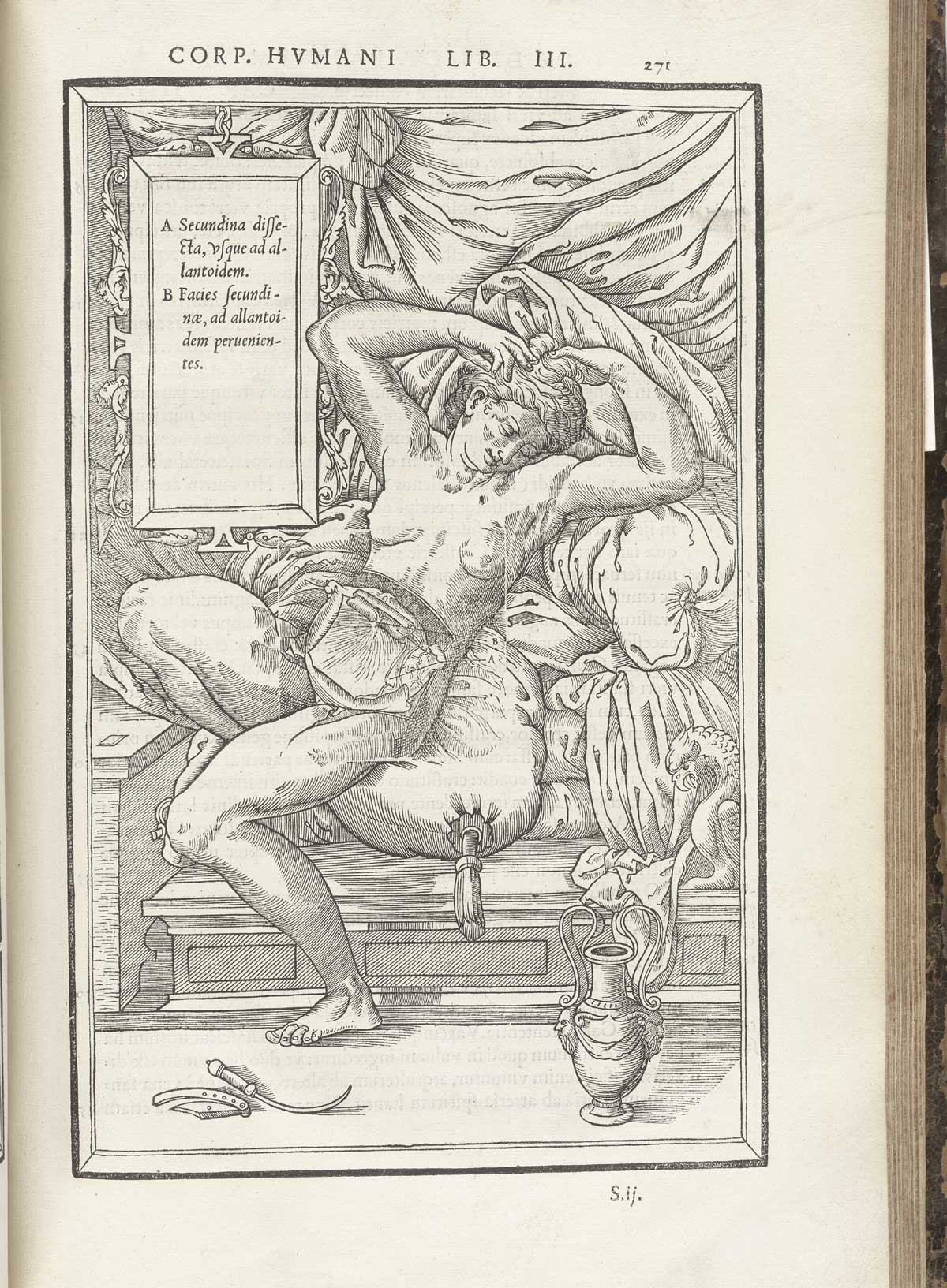 Woodcut of a facing pregnant female figure laying back on luxurious cushions with layers of flesh removed from the abdomen to reveal the placenta and allantois; the woman has long flowing hair and is facing the viewer; a tablet giving text in Latin about the indicated body parts hangs above and to the left of the figure; from Charles Estienne’s De dissection partium corporis humani libri tres, NLM Call no.: WZ 240 E81dd 1545.