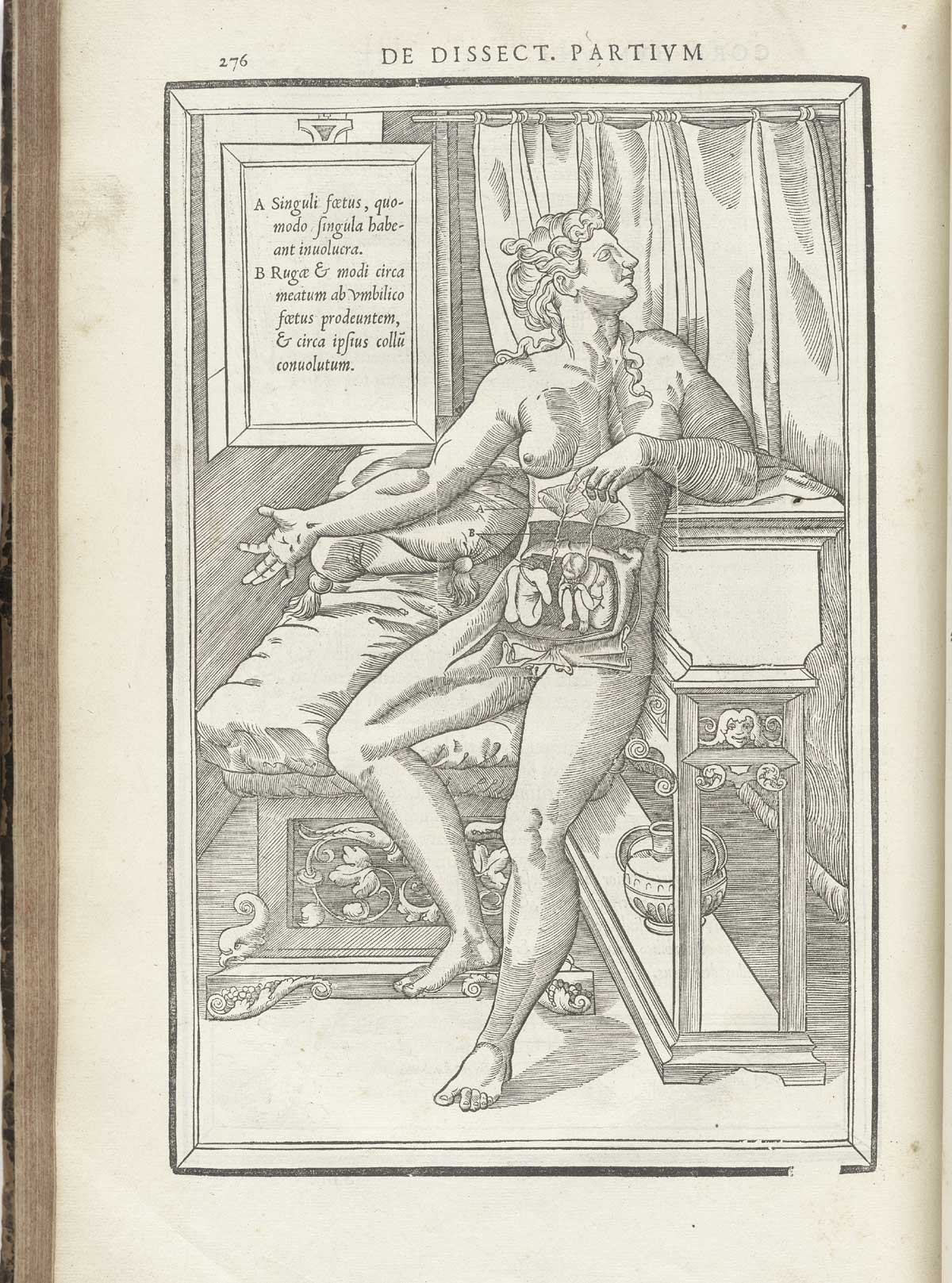 Woodcut of a facing pregnant female figure laying back on luxurious cushions with layers of flesh removed from the abdomen to reveal two placentas and fetuses; the woman has long flowing hair and is facing to the right; a tablet giving text in Latin about the indicated body parts hangs above and to the left of the figure; from Charles Estienne’s De dissection partium corporis humani libri tres, NLM Call no.: WZ 240 E81dd 1545.