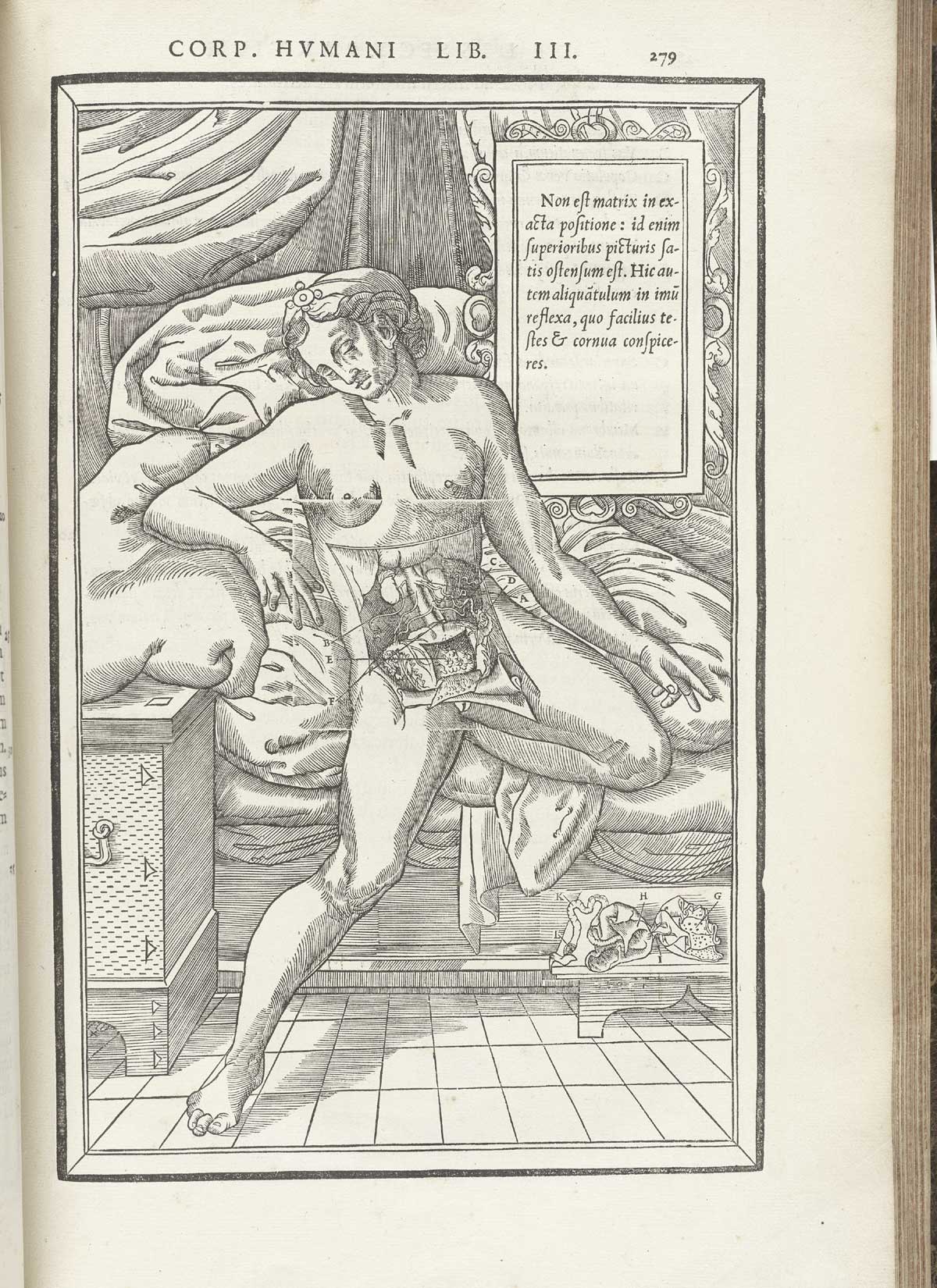 Pregnant female figure, from Charles Estienne’s De dissection partium corporis humani libri tres, NLM Call no.: WZ 240 E81dd 1545.