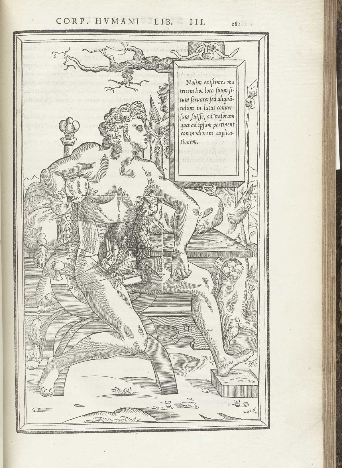 Woodcut of a facing female figure laying back on a Savonarola chair with layers of flesh removed from the abdomen to reveal the veins and arteries that attend the female reproductive system; the woman has flowing hair and is facing to the right; a tablet giving text in Latin about the indicated body parts hangs above and to the right of the figure; from Charles Estienne’s De dissection partium corporis humani libri tres, NLM Call no.: WZ 240 E81dd 1545.