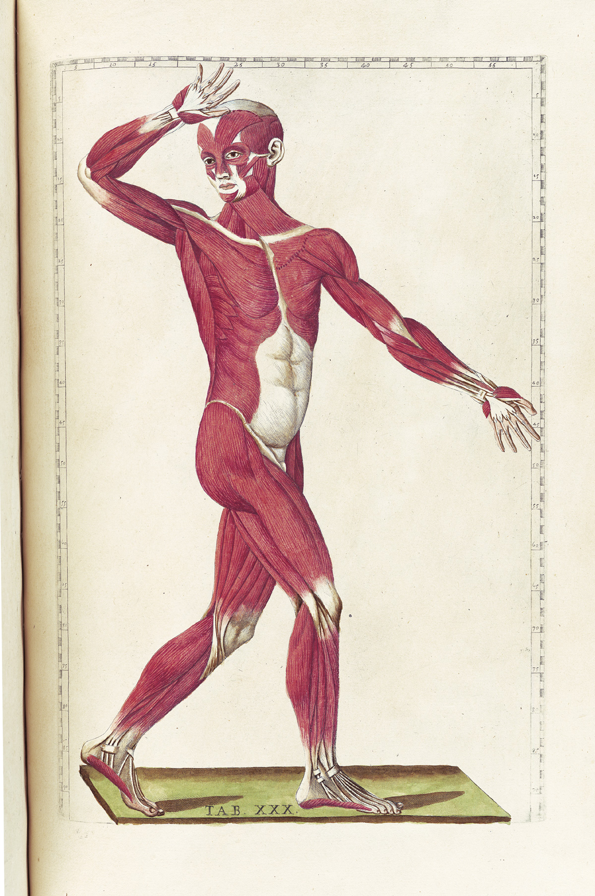 Hand-colored etching of a facing walking figure with flesh removed to expose the muscles; the figure is facing the viewer looking to the left side of the page with right arm raised and bent at the elbow and touching his forehead with palm out; from Bartholomeo Eustachi’s Tabulae anatomicae, NLM Call no.: WZ 260 E87t 1783.