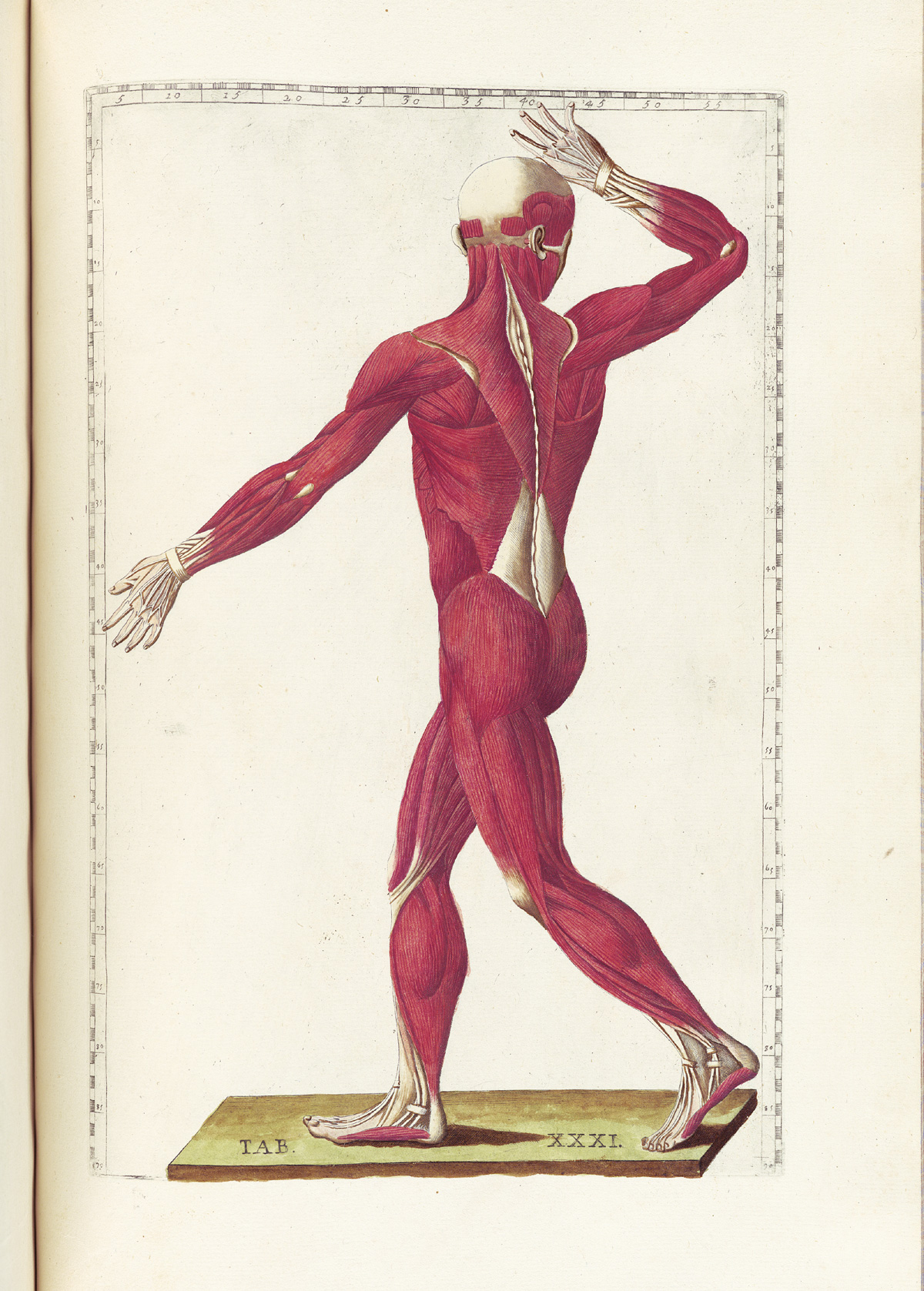 Hand-colored etching of a walking figure with flesh removed to expose the muscles; the figure is facing away from the viewer looking to the right side of the page with right arm raised and bent at the elbow and touching his forehead with palm out; from Bartholomeo Eustachi’s Tabulae anatomicae, NLM Call no.: WZ 260 E87t 1783.