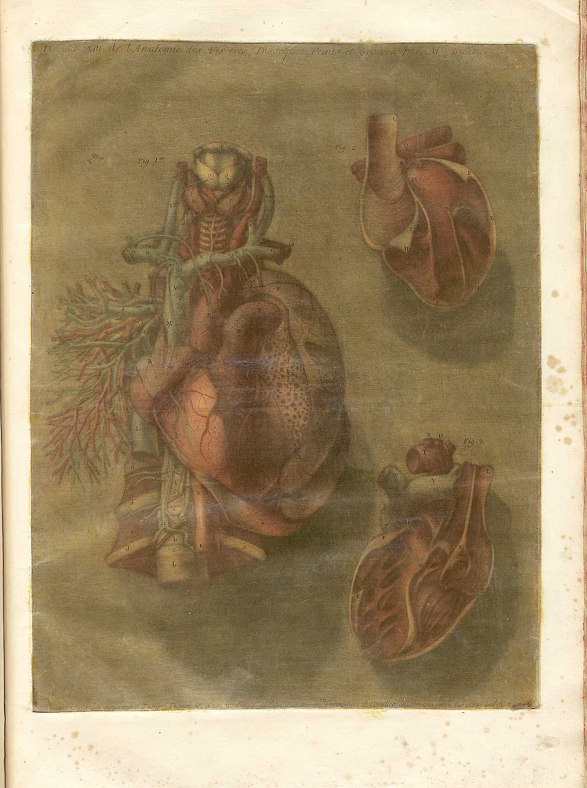 Color mezzotint of three views of the heart: the largest, in the center is a view from the front of the entire cardiovascular system with the trachea and spinal cord behind it; to the right at top and bottom are cross-sections of the heart; from Jacques Fabian Gautier d’Agoty’s Anatomie générale des viscères en situation, NLM Call no.: WZ 260 G283c 1745.