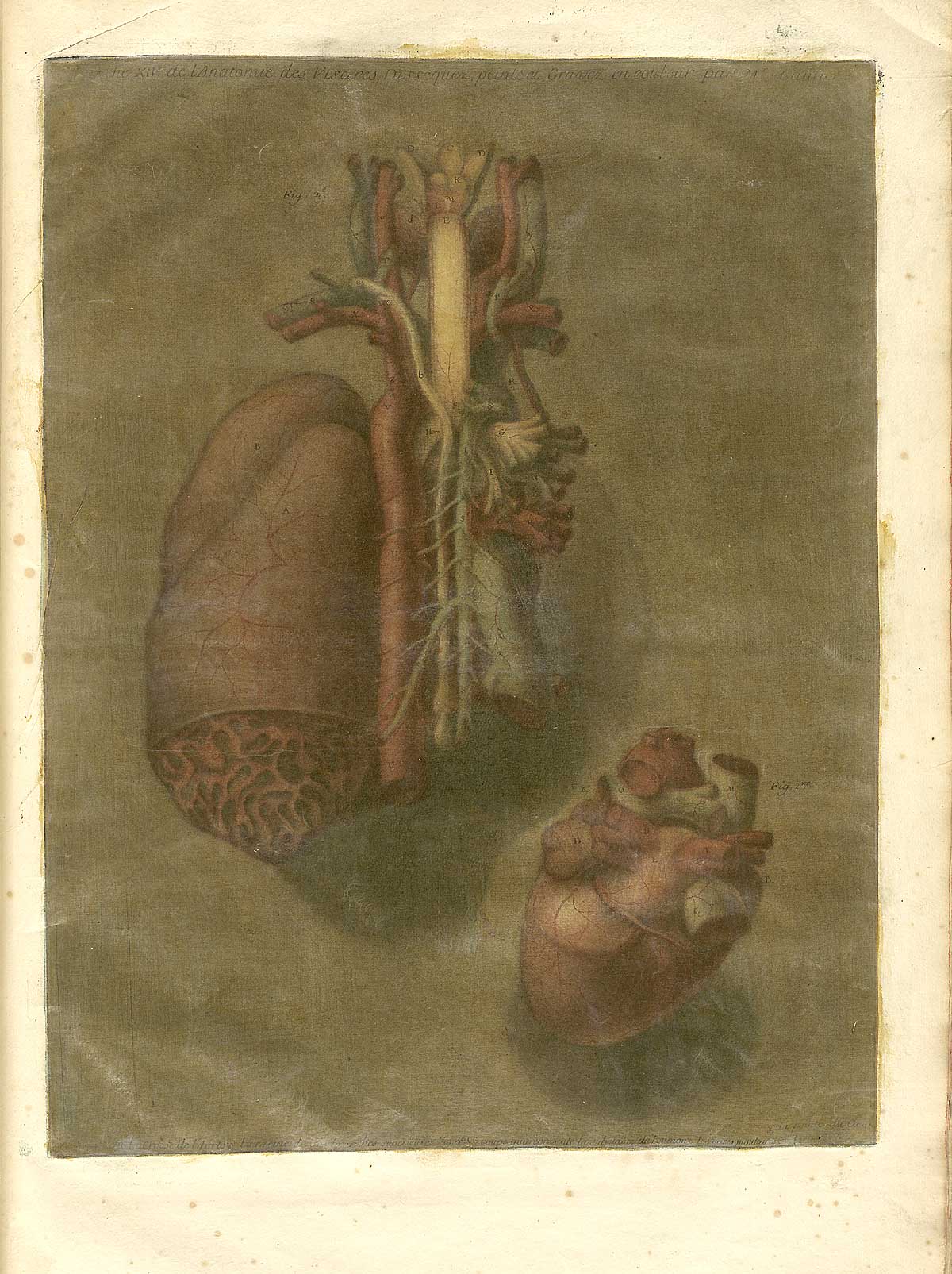 Color mezzotint of two views of the heart: the largest, in the center of the page is a view from the rear with part of the underside dissected; to the right at top is a smaller view of the heart from above; from Jacques Fabian Gautier d’Agoty’s Anatomie générale des viscères en situation, NLM Call no.: WZ 260 G283c 1745.