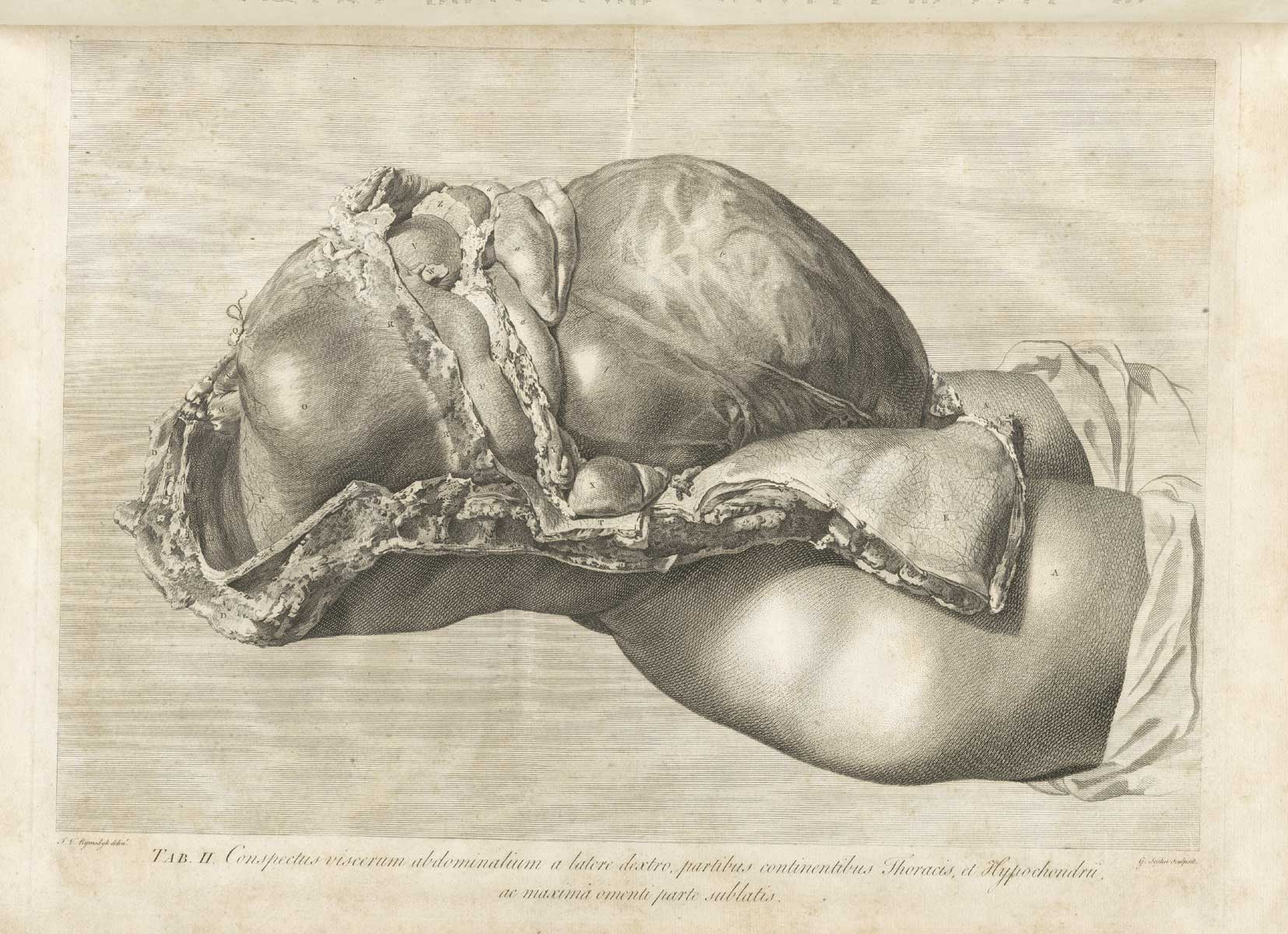 Table 2 of William Hunter's Anatomia uteri humani gravidi tabulis illustrata, featuring the right side view of female dissected to expose the gravid uterus.