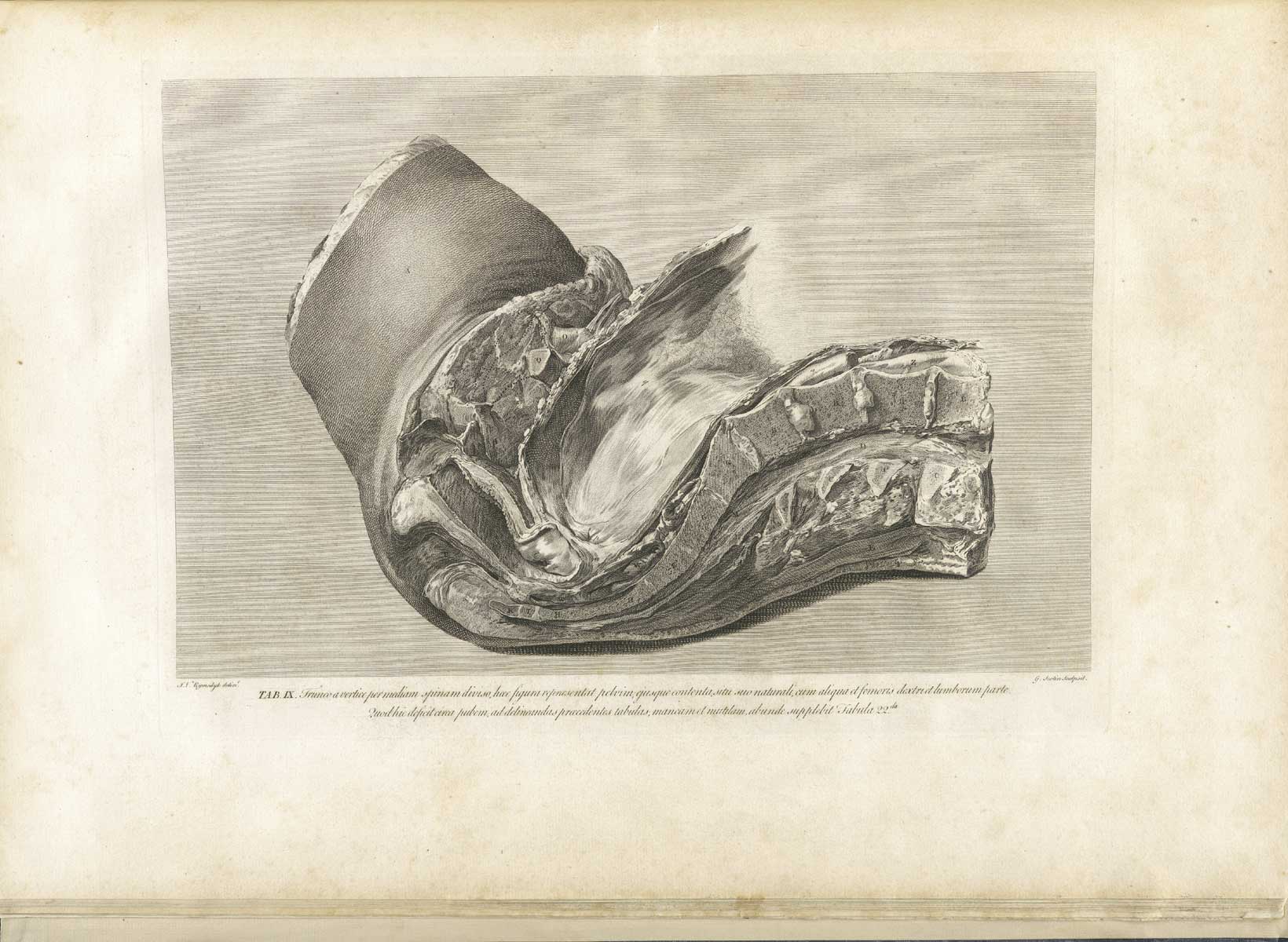 Table 9 of William Hunter's Anatomia uteri humani gravidi tabulis illustrata, featuring an illuminated inital of five small children putting a skull into a cooking pot over a fire.