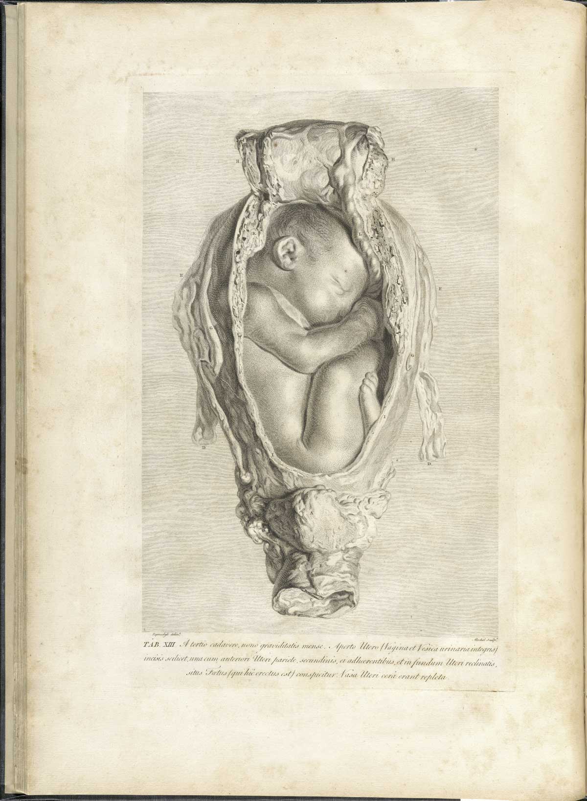 Table 13 of William Hunter's Anatomia uteri humani gravidi tabulis illustrata, featuring the cross section of a detached uterus with a fetus in breech position.
