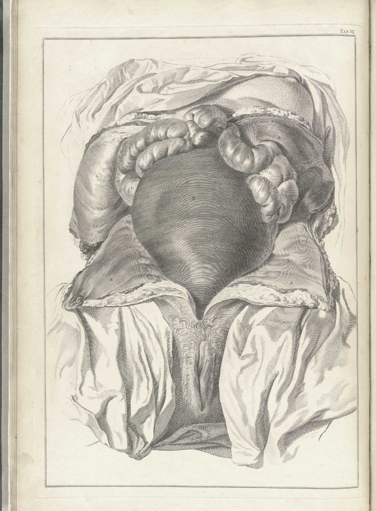 Table 7 of William Smellie's A sett of anatomical tables, with explanations, and an abridgment, of the practice of midwifery, featuring the illustrated drawing of a pregnant woman's uterus.