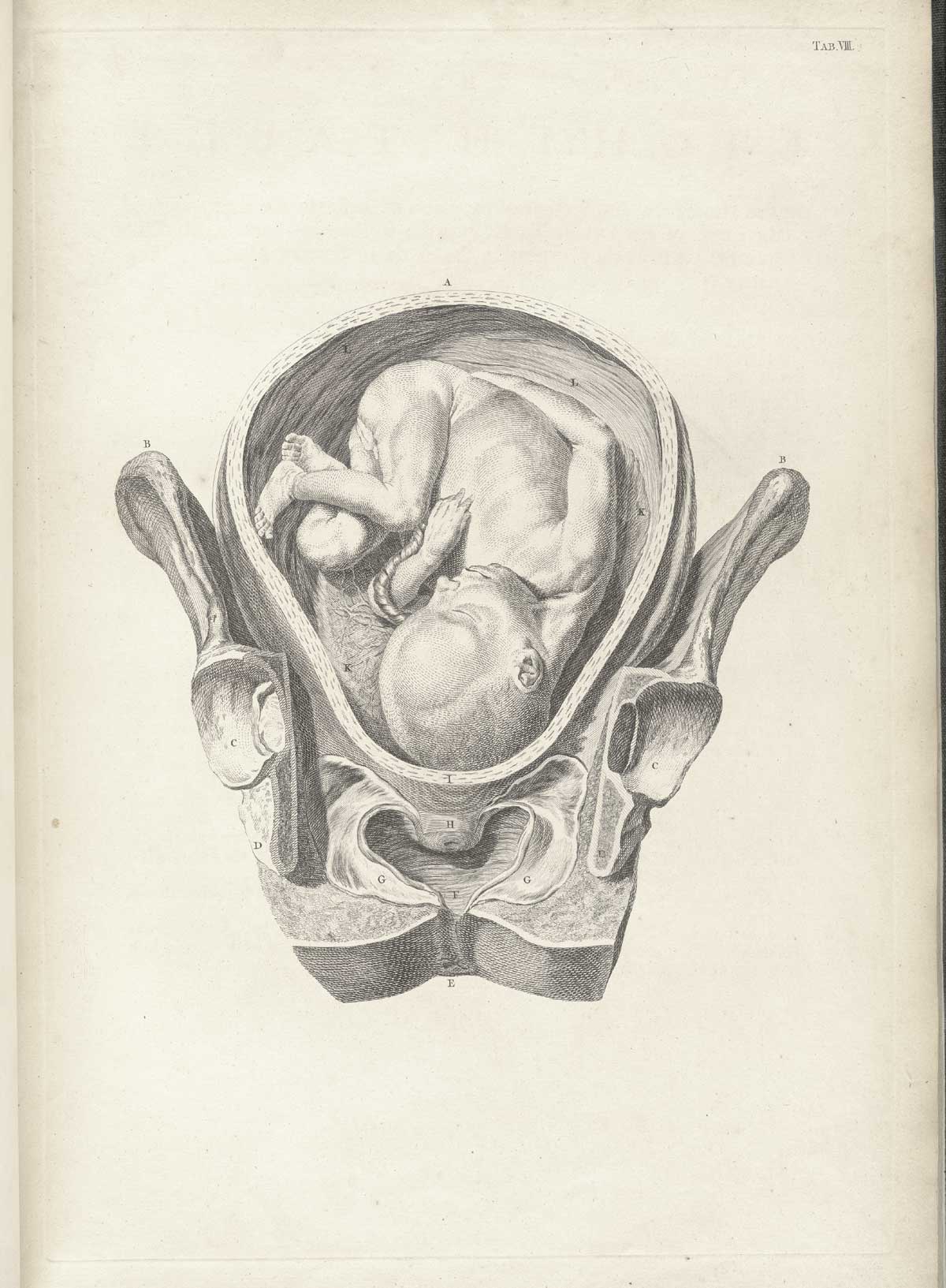 Table 8 of William Smellie's A sett of anatomical tables, with explanations, and an abridgment, of the practice of midwifery, featuring the illustrated drawing of a woman's pelvis and uterus with a fetus.