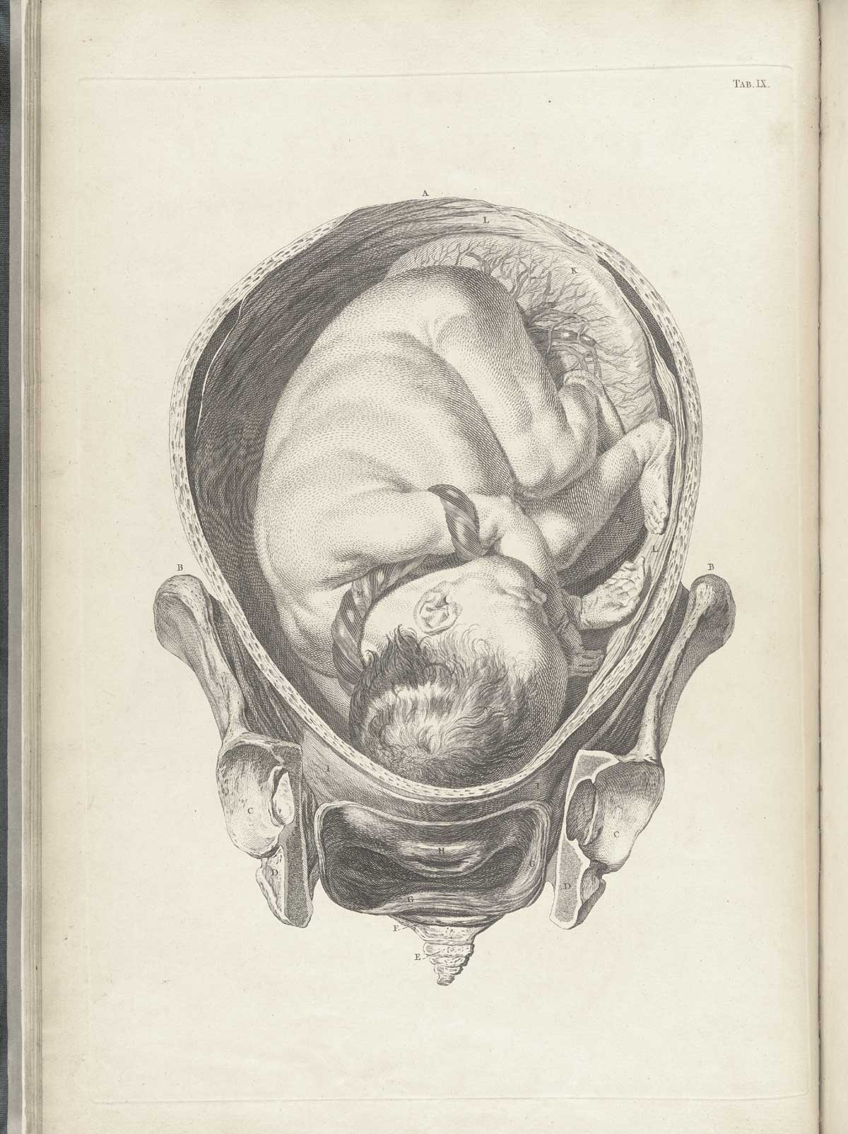 Table 9 of William Smellie's A sett of anatomical tables, with explanations, and an abridgment, of the practice of midwifery, featuring the illustrated drawing of a woman's pelvis and uterus with a fetus.