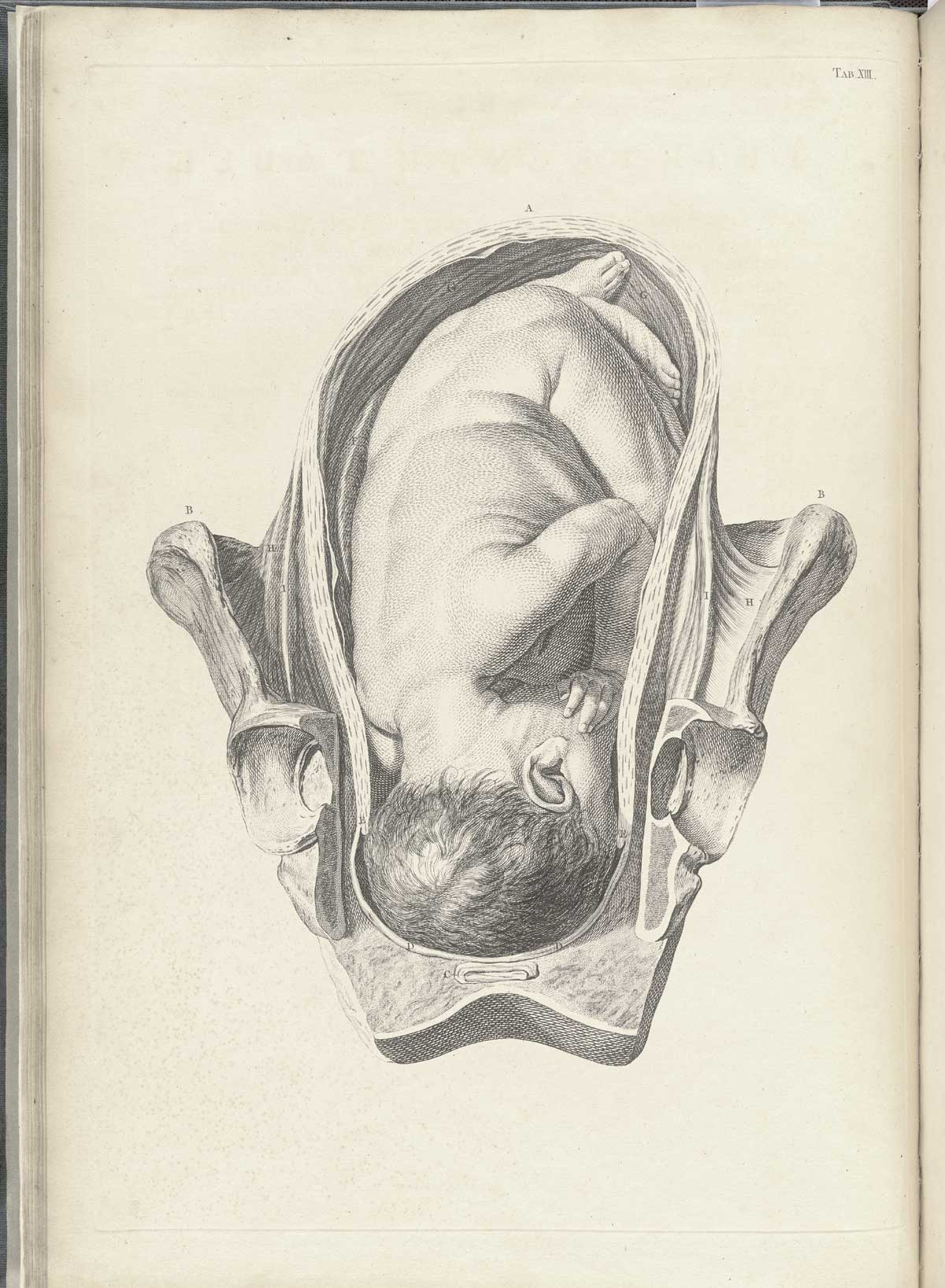 Table 13 of William Smellie's A sett of anatomical tables, with explanations, and an abridgment, of the practice of midwifery, featuring the illustrated drawing of a woman's pelvis and uterus with a fetus.