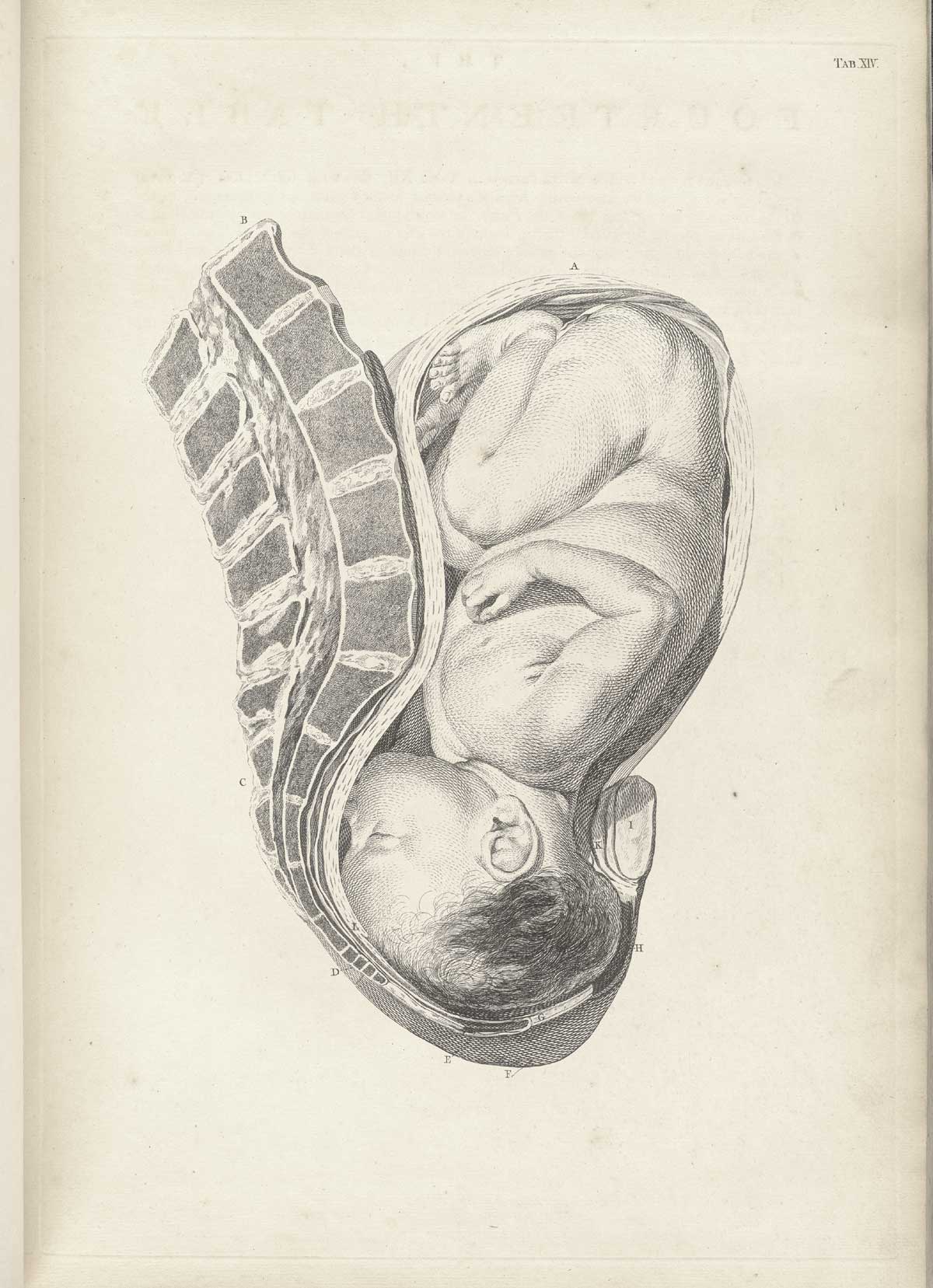 Table 14 of William Smellie's A sett of anatomical tables, with explanations, and an abridgment, of the practice of midwifery, featuring the illustrated drawing of a woman's uterus with a fetus resting against the spine.