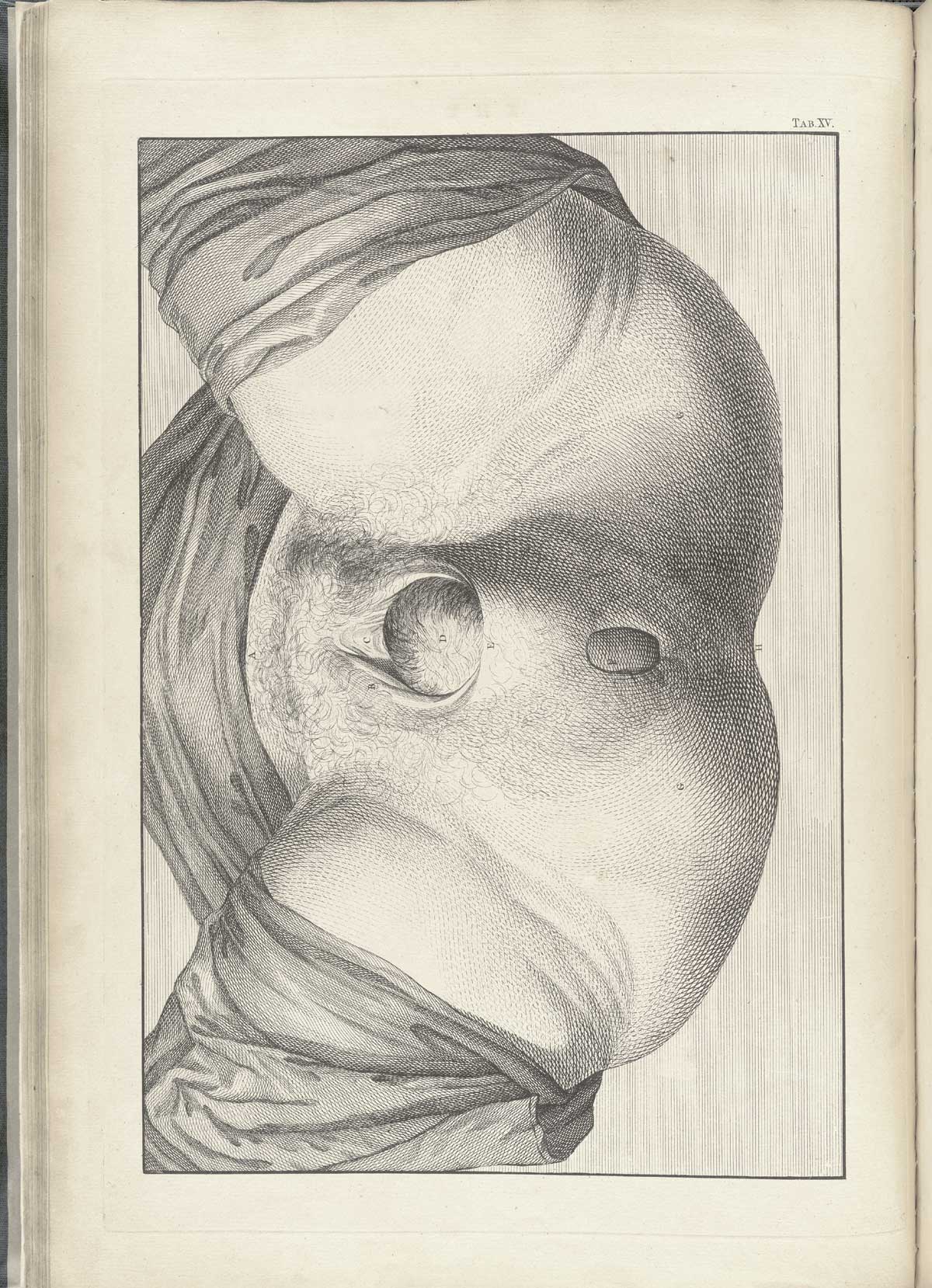 Table 15 of William Smellie's A sett of anatomical tables, with explanations, and an abridgment, of the practice of midwifery, featuring the illustrated drawing of a woman's vagina with a fetus' head crowning.