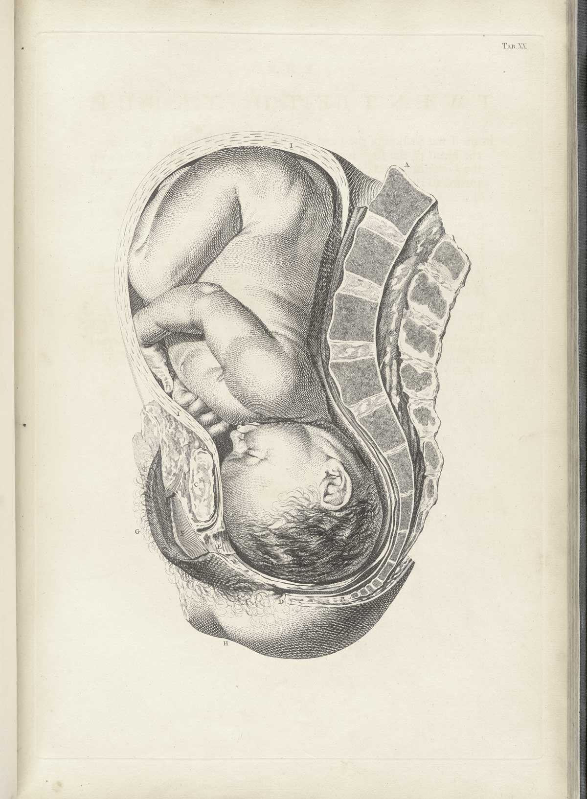 Table 20 of William Smellie's A sett of anatomical tables, with explanations, and an abridgment, of the practice of midwifery, featuring the illustrated drawing of a woman's uterus with a fetus resting against the spine.