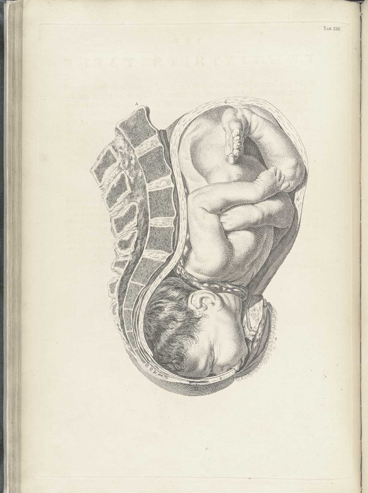 Table 23 of William Smellie's A sett of anatomical tables, with explanations, and an abridgment, of the practice of midwifery, featuring the illustrated drawing of a woman's uterus with a fetus resting against the spine, the imbilical cord is wrapped around its neck.
