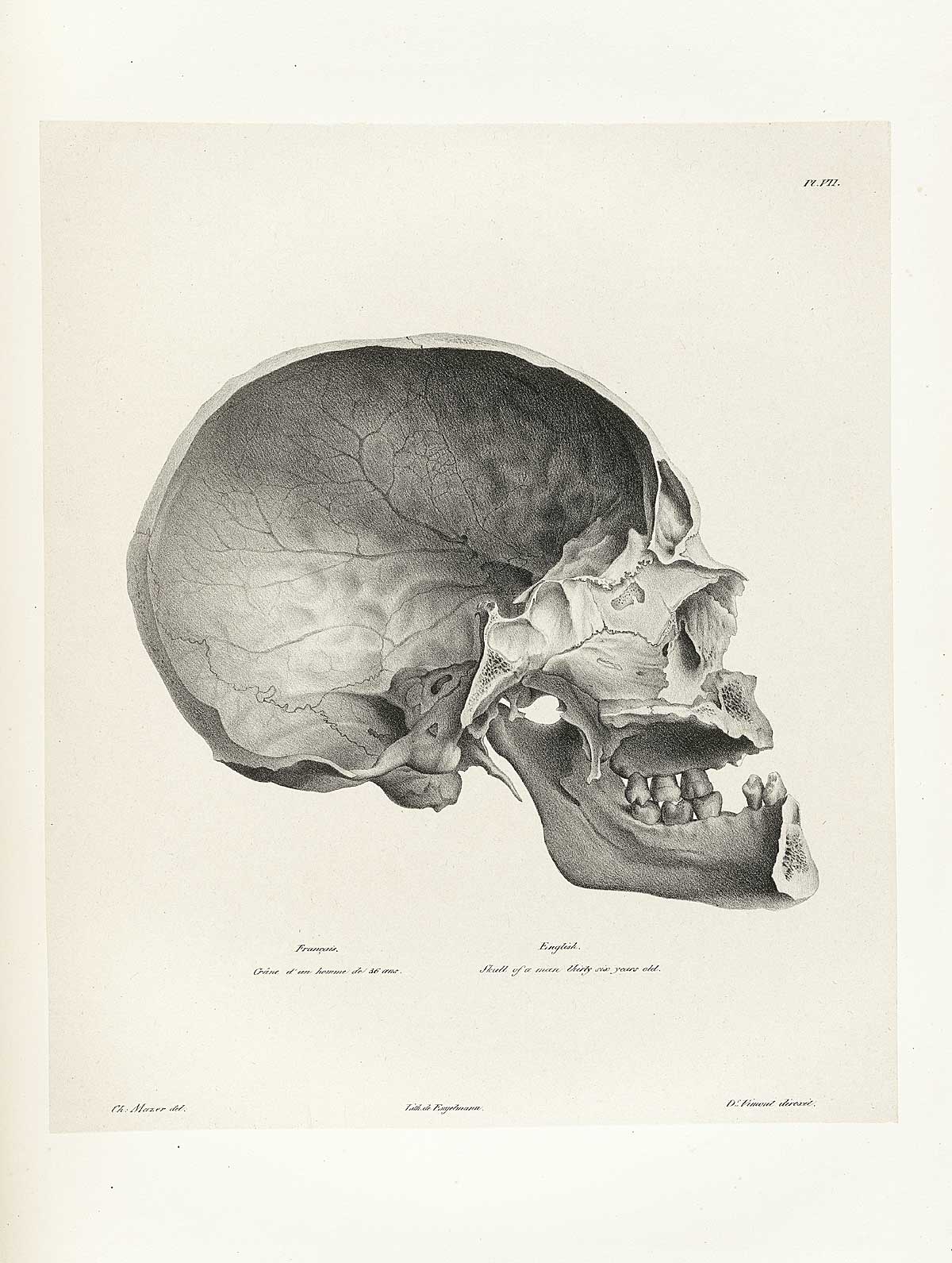 Table 7 of Joseph Vimont's Traité de phrénologie humaine et comparée, featuring the side view of a skull of a thirty six year old man.