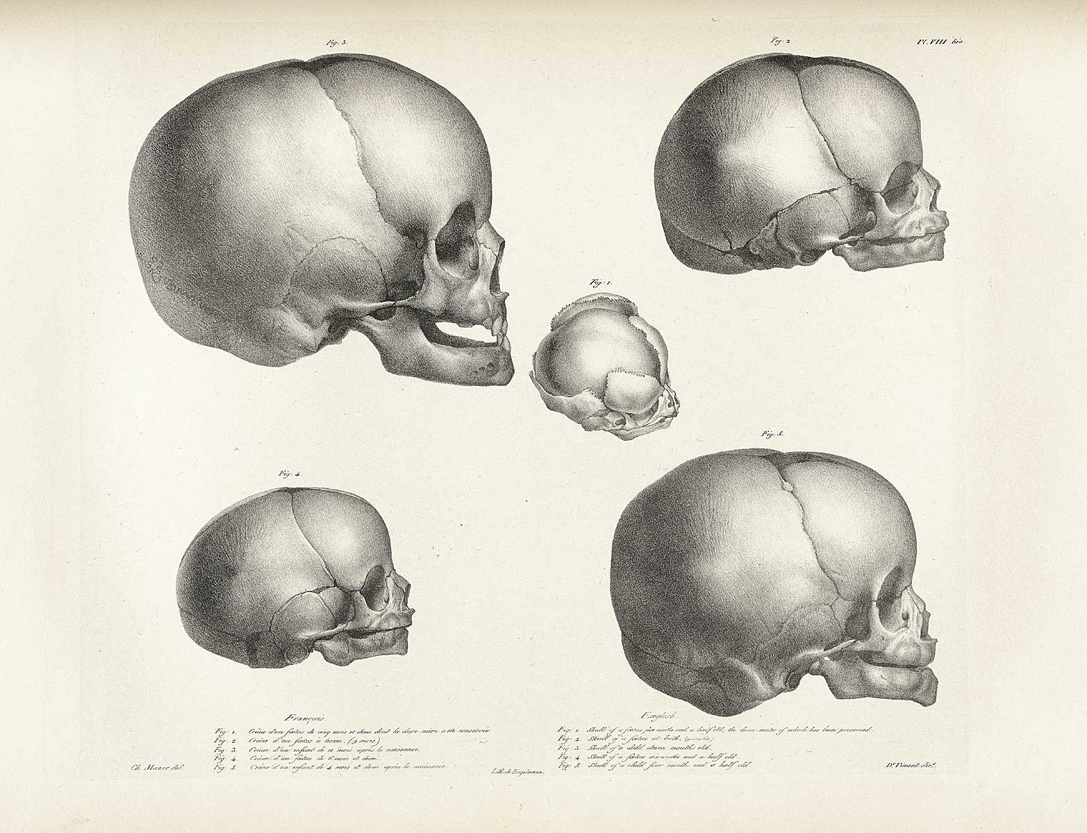 Table 8 of Joseph Vimont's Traité de phrénologie humaine et comparée, featuring the 5 skulls of fetus and children.