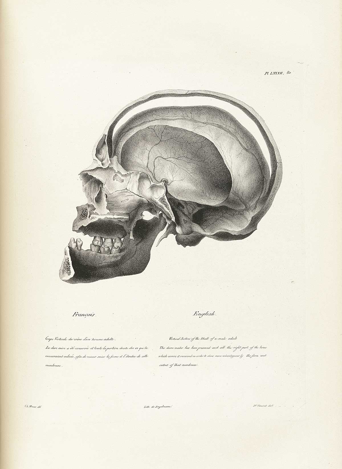 Table 82a of Joseph Vimont's Traité de phrénologie humaine et comparée, featuring the vertical secion of the skull of a male adult.