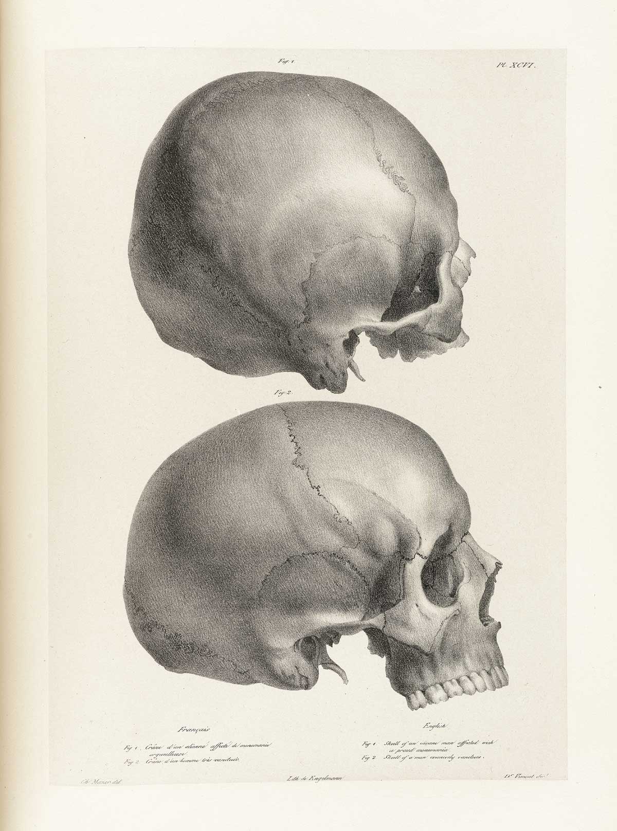 Table 96 of Joseph Vimont's Traité de phrénologie humaine et comparée, featuring the skull of an insane man affected with monomania and the skull of a conceited man.