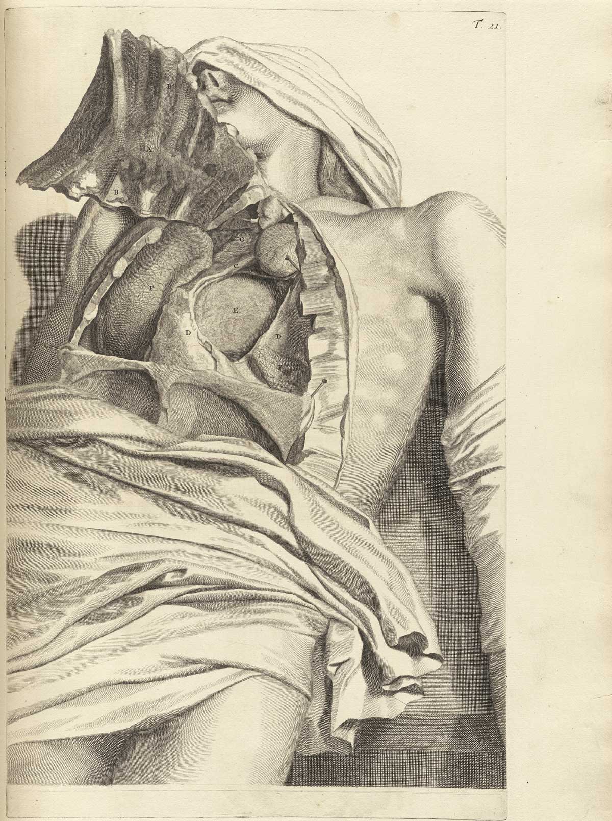 Engraving of an exposed thoracic cavity, probably male, with the sternum detached at the bottom and lifted up, exposing the diaphragm, lungs, heart, and pericardium; the lower portion of the cadaver’s abdomen is covered with a sheet with the legs descending below out of sight; from Govard Bidloo’s Ontleding Des Menschelyken Lichaams, Amsterdam, 1690, NLM Call no. WZ 250 B5855anDu 1690.
