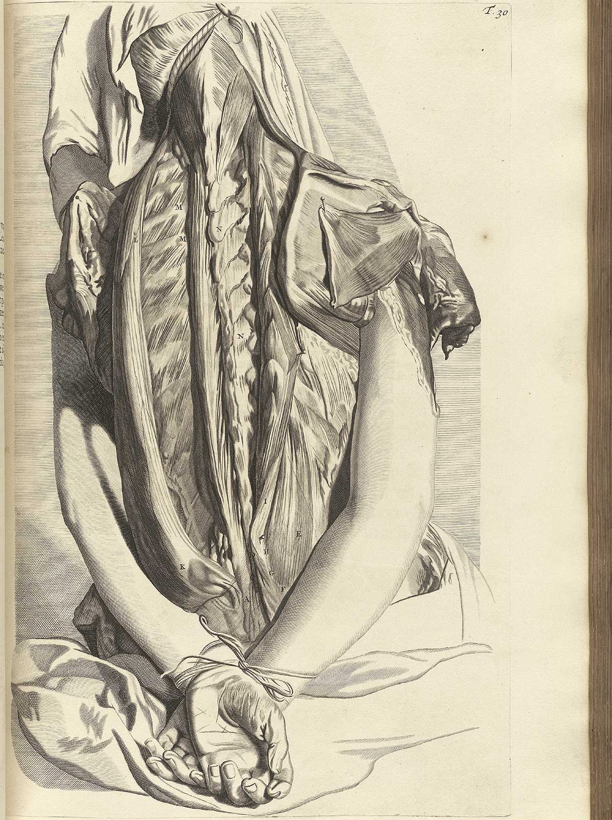 Engraving showing detail of the exposed muscles of the back with emphasis on the muscles surrounding the vertebral column with skin peeled away; the back is that of a female cadaver with sheet over her head sitting upright on the dissection table with a noose holding the body up by the neck, with her hand tied behind her back; from Govard Bidloo’s Ontleding Des Menschelyken Lichaams, Amsterdam, 1690, NLM Call no. WZ 250 B5855anDu 1690.