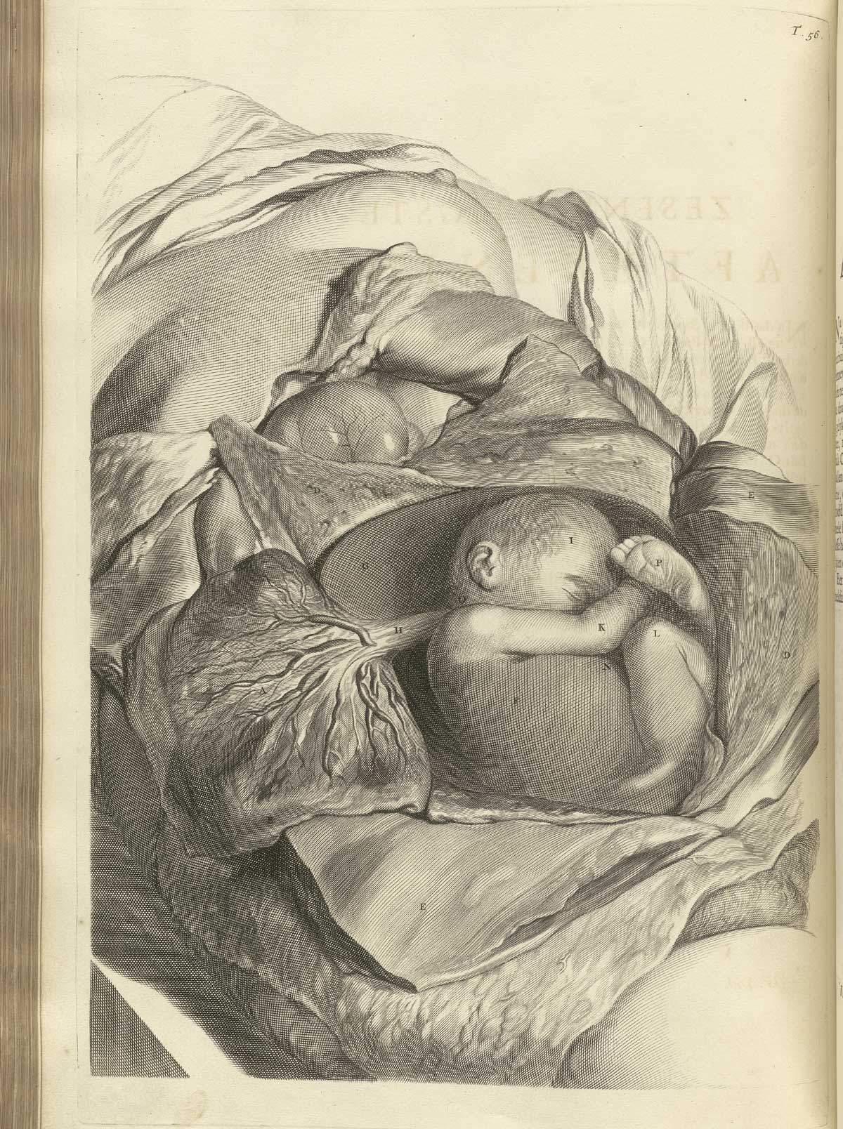 Engraving of a pregnant woman’s abdomen opened showing a well-developed fetus in utero with its amniotic sac and umbilical cord lying to the left; a sheet is draped around the edges of the open cavity; from Govard Bidloo’s Ontleding Des Menschelyken Lichaams, Amsterdam, 1690, NLM Call no. WZ 250 B5855anDu 1690.