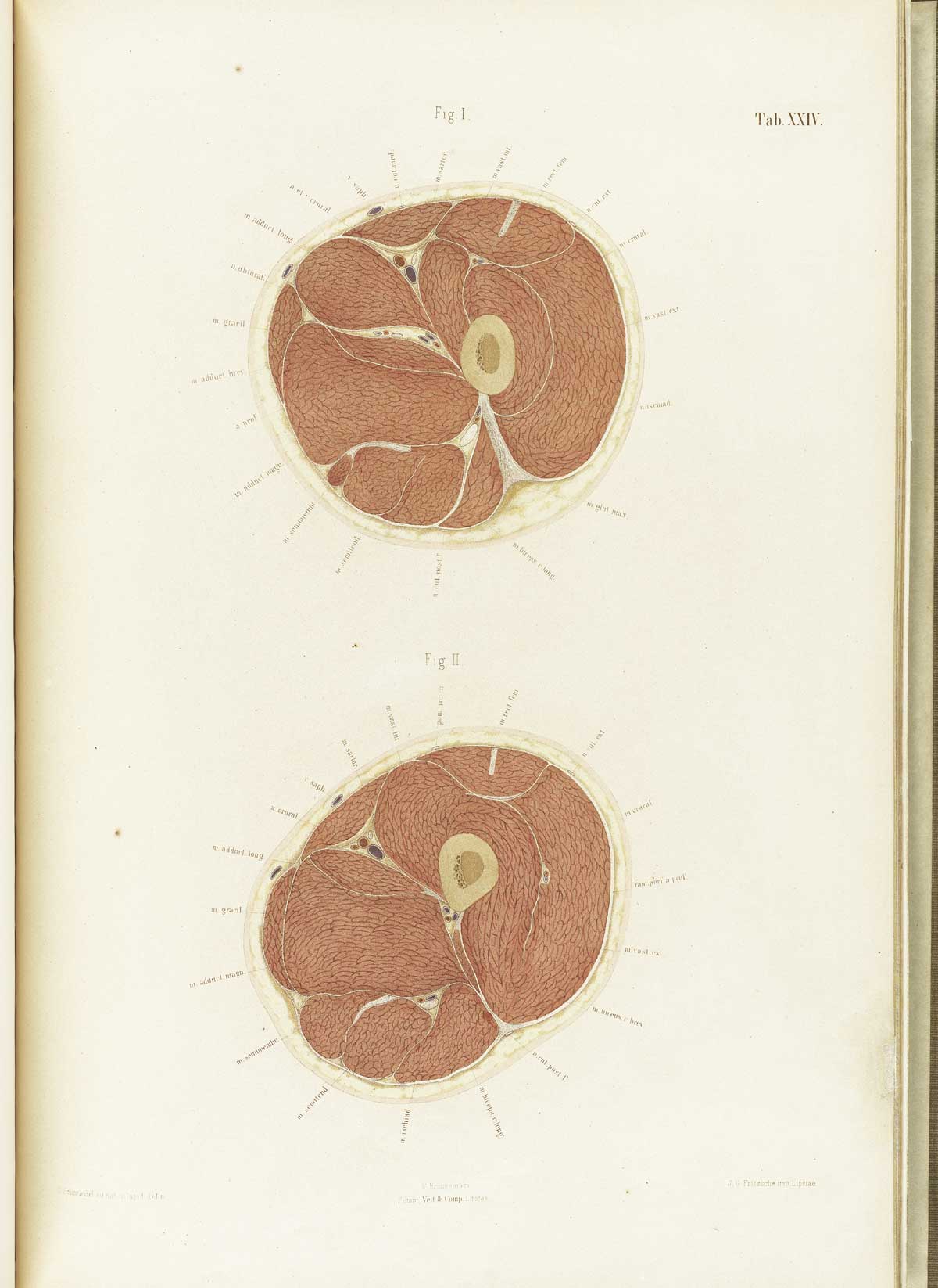 Chromolithograph of cross-sections of two legs at the thigh, one on top of the page, the other below, showing the muscles, bones, and other structures, from Wilhelm Braune’s Topographisch-anatomischer Atlas. Leipzig, 1867.