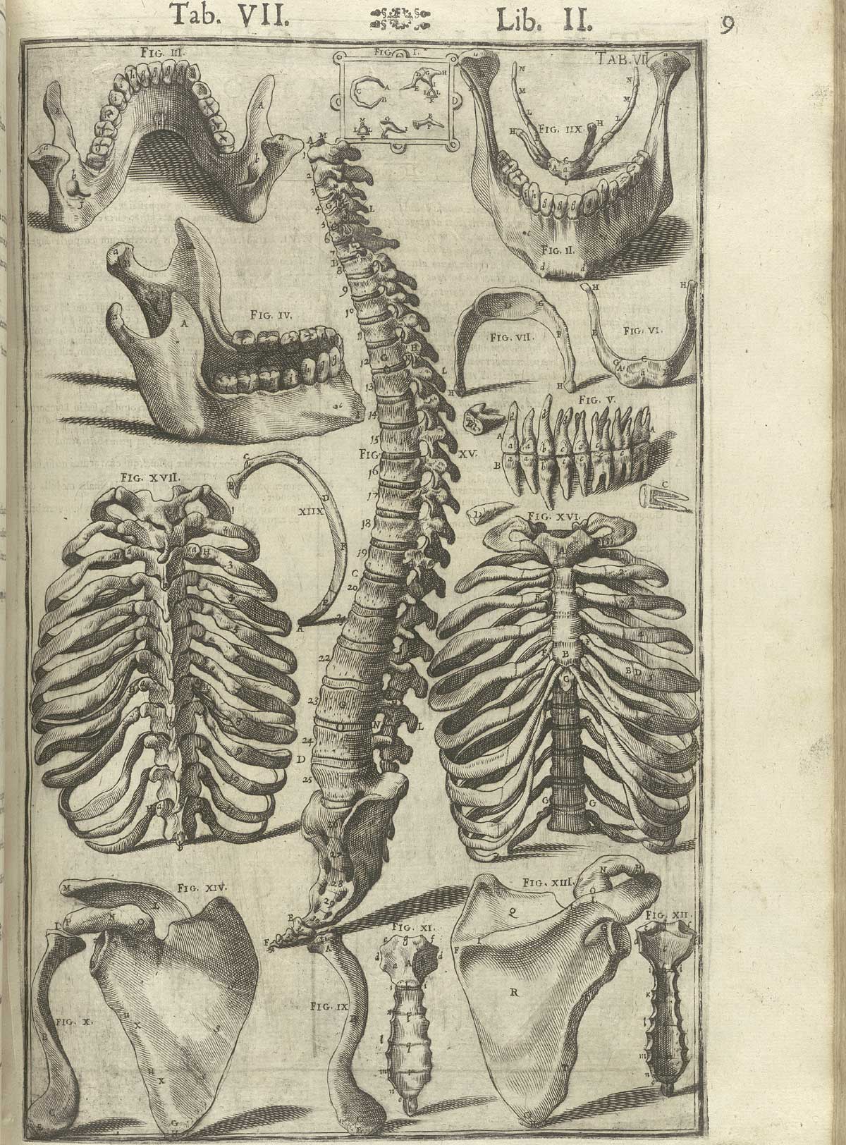 Engraving of various bones arranged compactly on the page, including a spinal column in the middle and the ribcage shown from the front and back on either side, three views of the mandible, the teeth, and the shoulder blade from two angles, from Adriaan van de Spiegel and Giulio Cassieri’s De humani corporis fabrica libri decem, Venice, 1627, NLM call no. WZ 250 S755dh 1627.