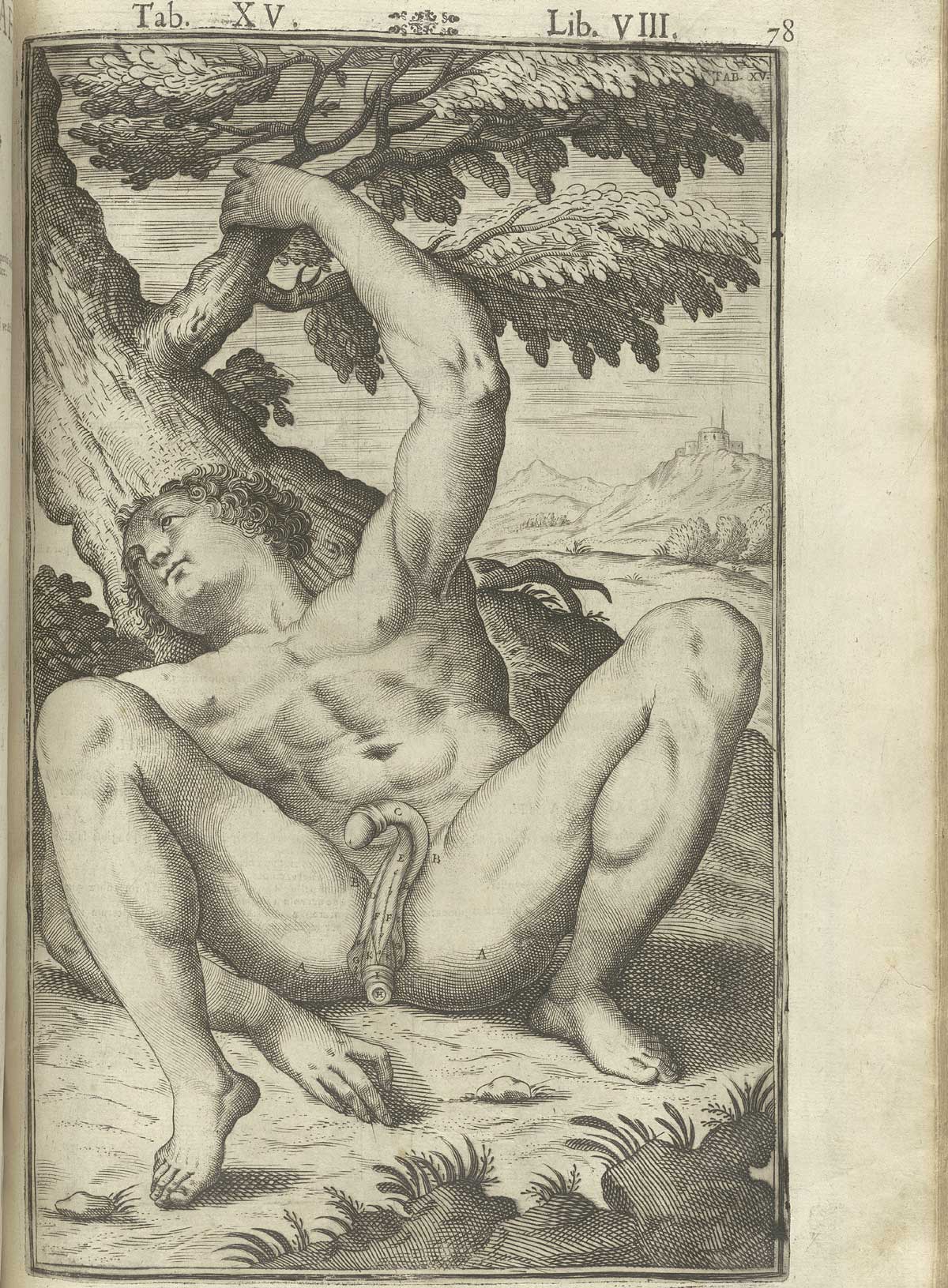 Engraving of recumbent nude male figure leaning against a tree in pastoral setting exposing his penis, anus, and buttocks, with some interior views of these structures, with his left arm raised touching a branch of the tree behind him; from Adriaan van de Spiegel and Giulio Cassieri’s De humani corporis fabrica libri decem, Venice, 1627, NLM call no. WZ 250 S755dh 1627.