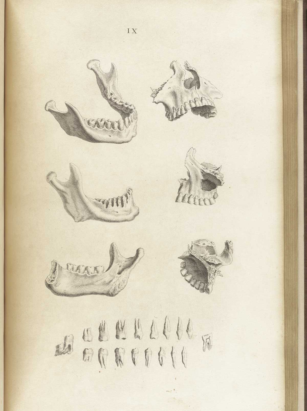 Engraving of three views of the mandible, three views of the maxilla, and 18 views of the teeth, including the cross-section of a molar, from William Cheselden’s Osteographia, NLM Call no.: WZ 260 C499o 1733.