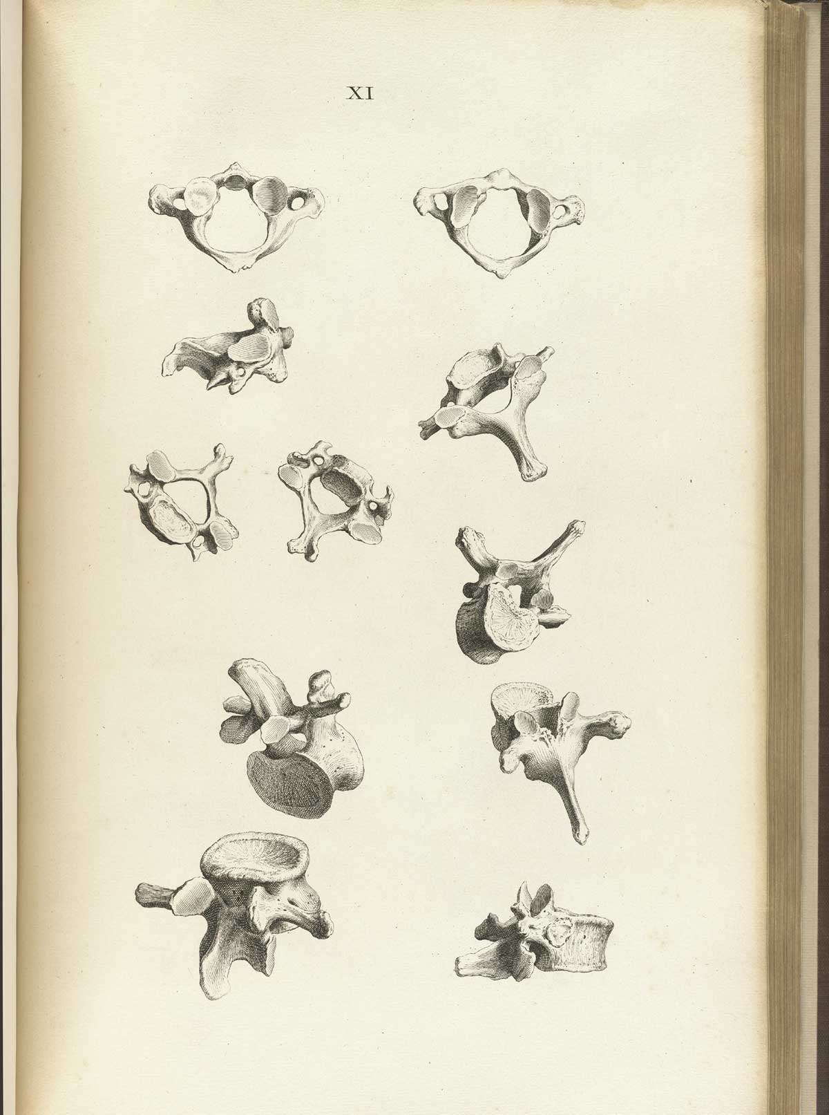 Engraving of eleven vertebrae viewed from different angles giving details of their different processes, from William Cheselden’s Osteographia, NLM Call no.: WZ 260 C499o 1733.