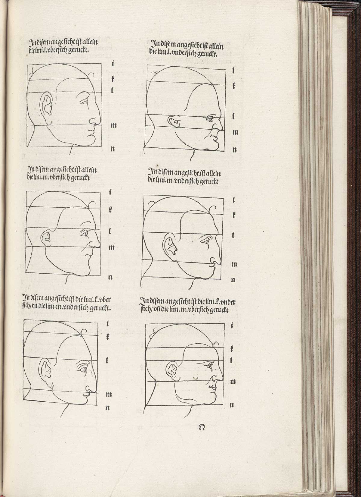Woodcut of six heads in profile, all facing to the left, with different facial proportions such as larger or smaller noses or more or less protruding brows, with lines cutting across the faces showing proportions of different distances, such as from top of eyelid to bottom of nose; from Albrecht Dürer’s Vier Bücher von menschlicher Proportion, NLM Call no. WZ 240 D853v 1528.