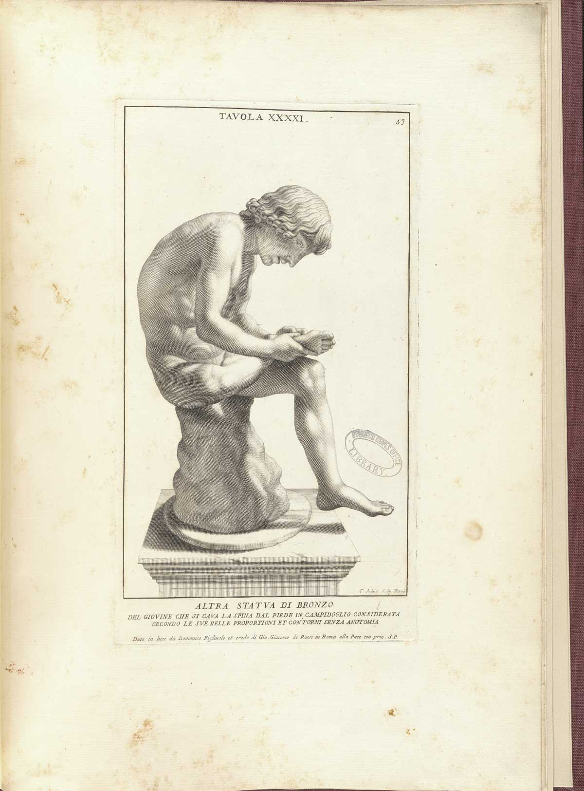 Engraving of the side view of a statue of a nude boy sitting on a stone hunched over removing a thorn from his right foot; from Bernardino Genga’s Anatomia per uso et intelligenza del disegno, NLM Call no.: WZ 250 G329an 1691.
