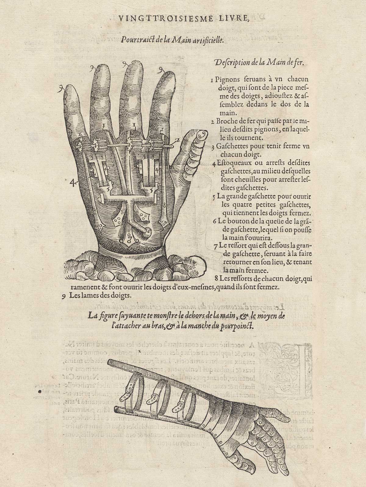 Woodcut of two prosthetic hands, the one on the top viewed in the palm, the lower one viewed looking down on the wrist, with typeset text in French to the right and between the two hands, from Ambroise Paré’s Oeuvres, NLM Call no.: WZ 240 P227 1585.